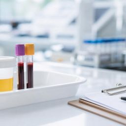 Urine sample cup and blood tubes on a lab tray
