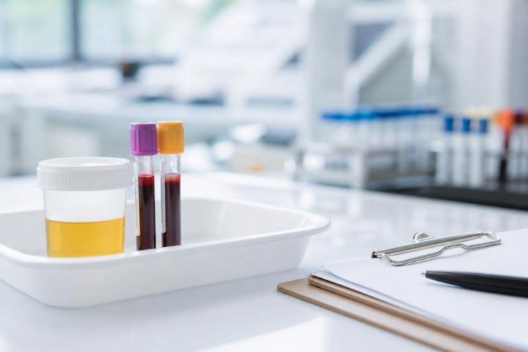 Urine sample cup and blood tubes on a lab tray