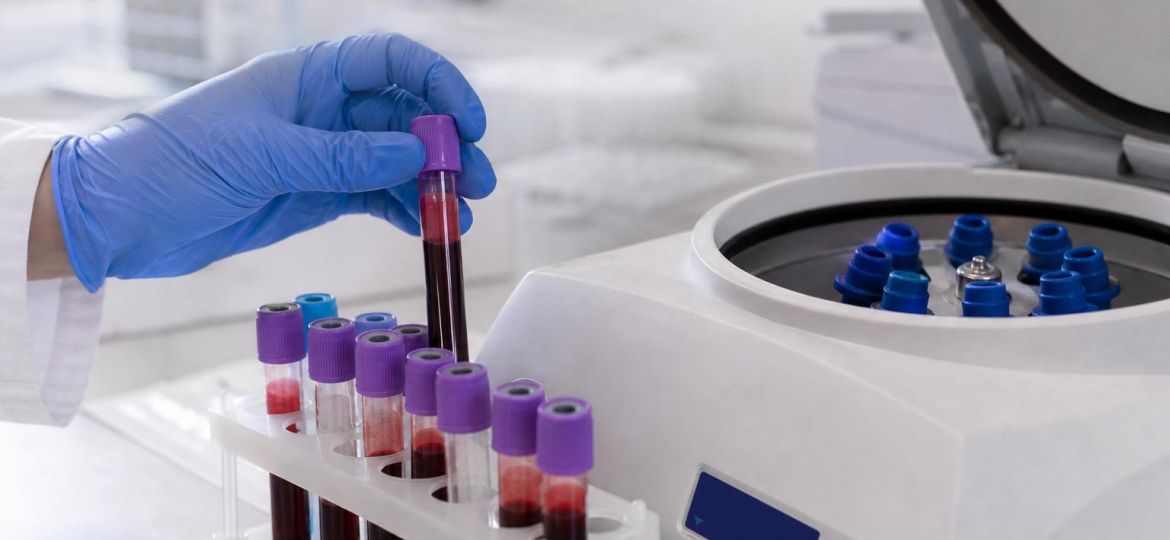 Blood sample tubes being placed in a rack in a lab