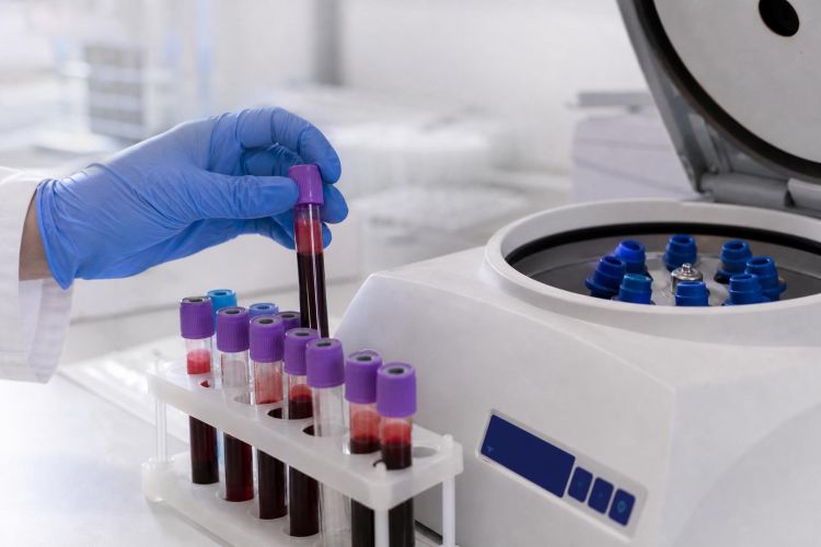Blood sample tubes being placed in a rack in a lab